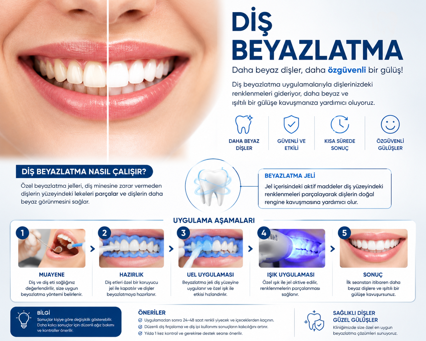 Profesyonel Diş Beyazlatma Uygulaması